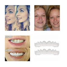 Load image into Gallery viewer, Magic Smile Teeth Brace